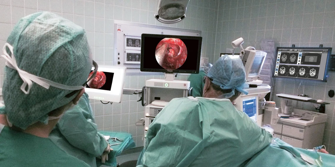 EndoSURGERY 3D Spectar EndoSURGERY 3D Spectar