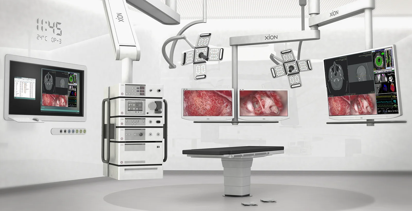 Systems in the hospital