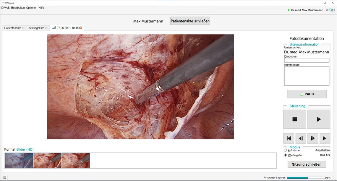 Documentation d’images et de vidéos DiVAS